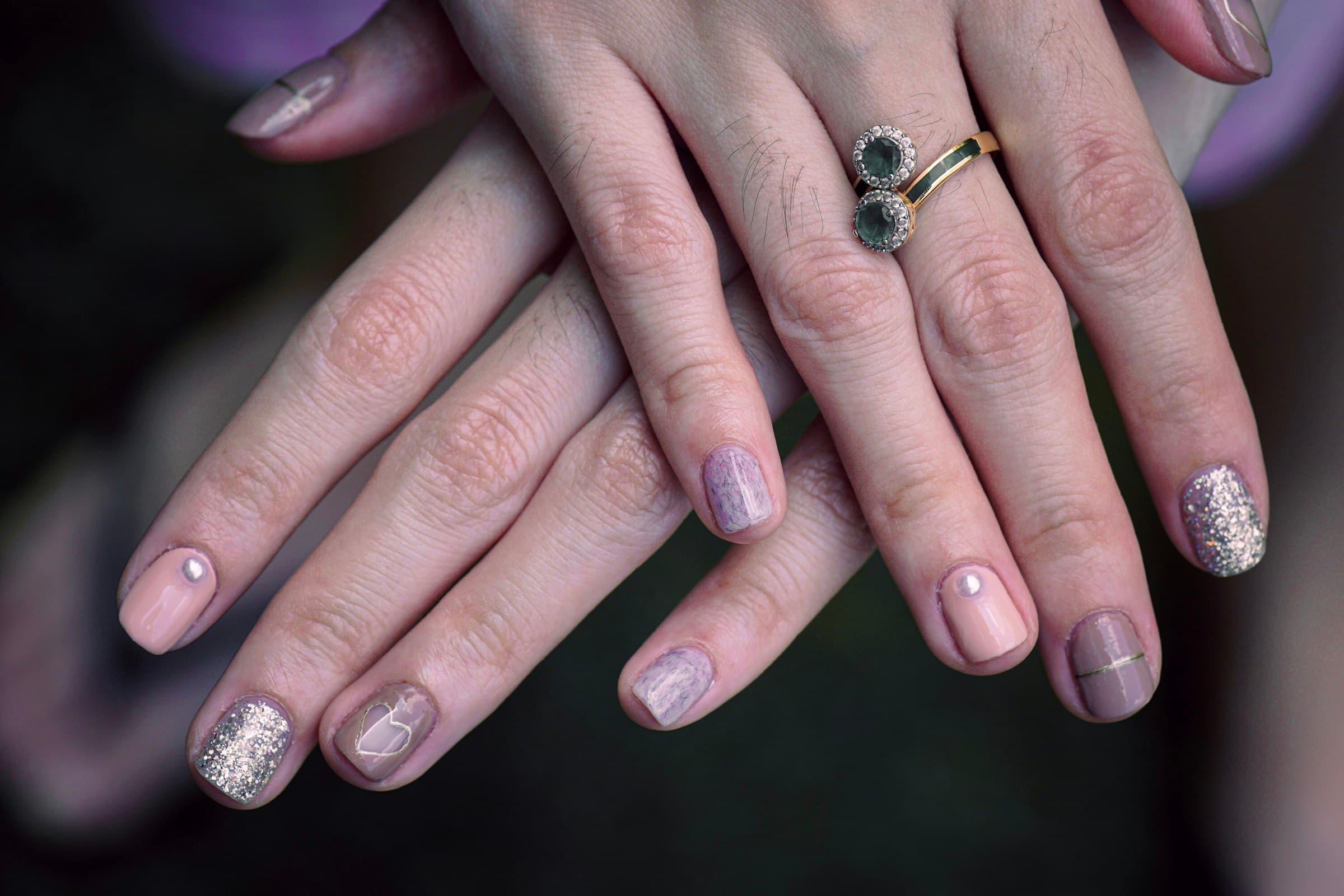 Mãos sobrepostas com esmalte lilás e glitter já gasto nas pontas das unhas